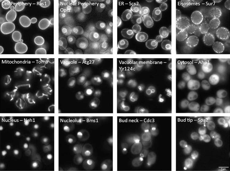 Abb. 1: Zellkompartiment-Lokalisation fluoreszenzmarkierter Proteine in Hefezellen. In jedem Bild sind das dargestellte Kompartiment (links) und der Standardname jedes markierten Proteins (rechts) angegeben.