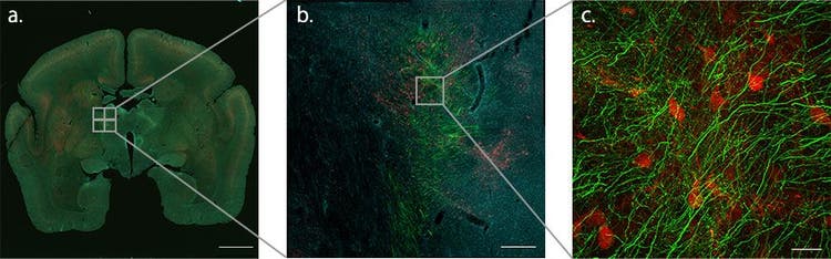 Abbildung 2. Verwendung der Makro-Mikro-Funktion, um aufzuzeigen, wo die Axonfasern auf dem Weg vom PFC zum Thalamus im Gehirn von Krallenaffen auf den TRN treffen. Da die TRN-Neuronen aus PV-positiven inhibitorischen Neuronen bestehen, können sie durch die PV-Antikörper (rot) identifiziert werden. Die Axonendigungen aus der Großhirnrinde sind grün und die Zellkerne cyan dargestellt.