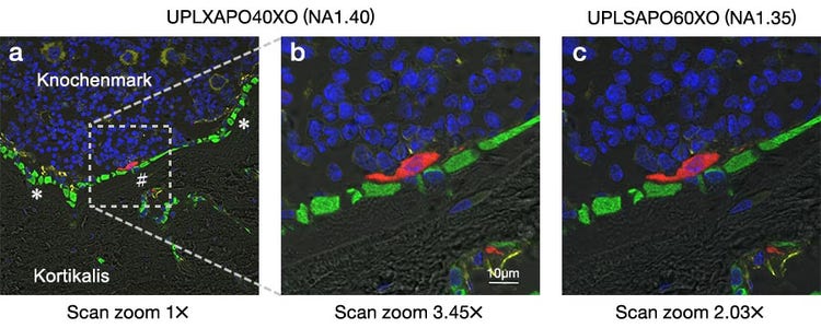 Abb. 2: Fluoreszenzbilder eines Querschnitts der Tibia einer Maus