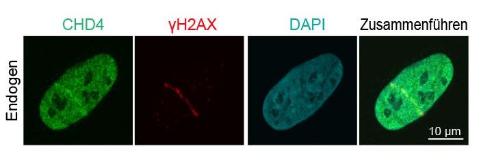 Abb. 3: Rekrutierung von endogenen DNA Damage Repair-Proteinen zu DNA-Strangbrüchen