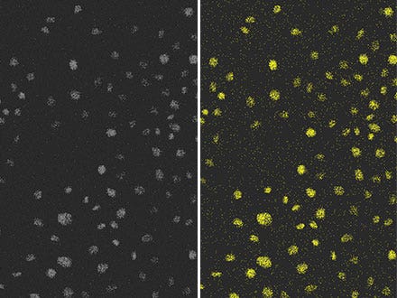 Abbildung 4: Das Ergebnis der Erkennung von Zellkernen (rechts) mit der gleichen konventionellen Methode wie in Abbildung 3 in Fluoreszenzbildern (links) mit extrem niedrigem Signal-Rausch-Abstand aufgrund des schwachen Anregungslichts. Die geringe Erkennungsgenauigkeit ist offensichtlich.