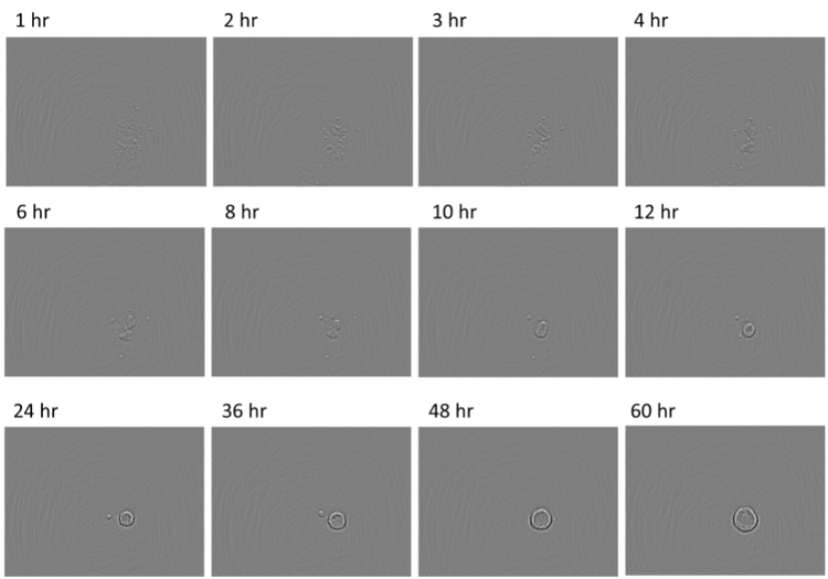 Abbildung 1. Sphäroidbildung ausgehend von neuralen Maus-Stammzellen