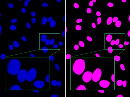 Abbildung 2: Im Vergleich zum Fluoreszenzbild (links) unterscheidet TruAI von Olympus nahe beieinander liegende Zellkerne deutlich voneinander (rechts) und erlaubt eine Erkennung mit hoher Genauigkeit.