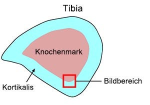 Abb. 1: Tibia-Querschnitt