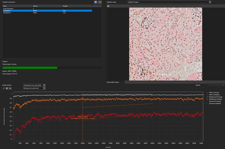 Das berechnete DNN wird auf die restlichen Nierenbilder angewendet, um die Glomeruli automatisch zu erkennen und zu segmentieren.