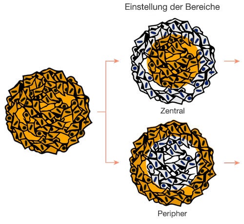 Einstellung der Bereiche