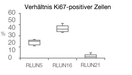 Verhältnis Ki67-positiver Zellen