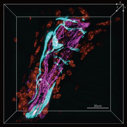 Abb. 1: Sensorische Nerven und umgebende Gefäße durchdringen ein Foramen in der tibialen Epiphyse (3D-Bild) Sensorische Nerven (EYFP, cyan), Blutgefäße (Alexa Fluor 594, magenta), Zellkerne (DAPI, orange)