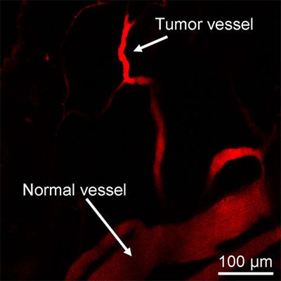 Abbildung 3: 2PF-Abbildung von mit unserem Fluorophor markierten Tumor- und normalen Blutgefäßen Das Tumorblutgefäß zeigt im Vergleich zum normalen Gefäß eine verstärkte 2PF. Anregung: 1200 nm; Emission: 660–750 nm. Copyright 2019, Wiley-VCH.