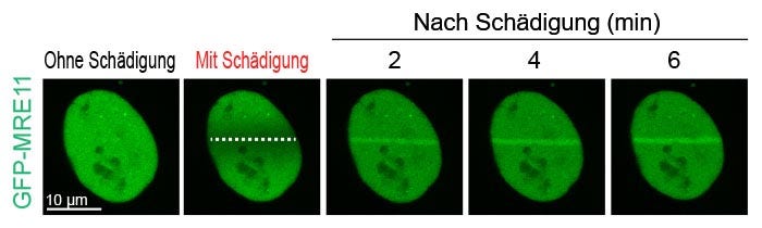 Abb. 2: Schadensabhängige Akkumulation von MRE11 an der DNA-Bruchstelle