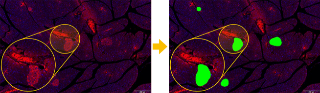 Effiziente Segmentierung morphologischer Merkmale