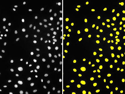 Abbildung 3: Das Ergebnis der Erkennung von Zellkernen (rechts) in einem Fluoreszenzbild (links) mit ausreichender Leuchtdichte mit einer herkömmlichen Methode (Auswertung einer Leuchtdichteschwelle).