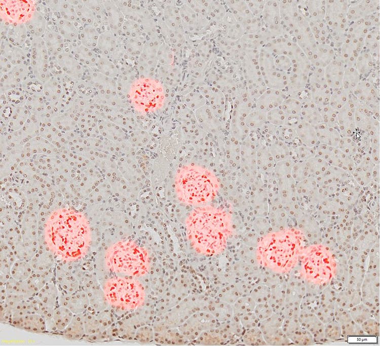 Das trainierte DNN erkennt und trennt die Glomeruli