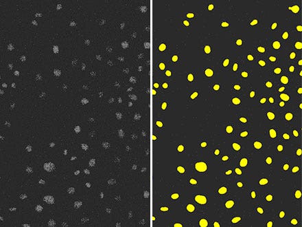 Abbildung 5: Das Ergebnis der Erkennung von Zellkernen (rechts) mit TruAI in einem Fluoreszenzbild (links) mit extrem niedrigem Signal-Rausch-Abstand aufgrund des schwachen Anregungslichts. Es ist gut erkennbar, dass die Genauigkeit genauso hoch ist wie in Abbildung 3 und deutlich höher als in Abbildung 4.