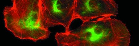 Fotomontage der interkontinentalen Allianz zwischen Krebsforschungszentren