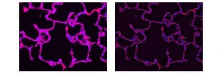 Beispiele für Mikroskopsysteme mit Super Resolution-Technologie