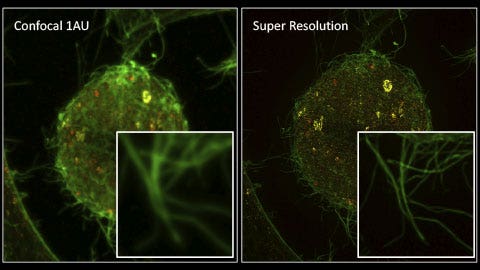 Super Resolution Imaging lebender Zellen: Das große Bild der kleinen Dinge