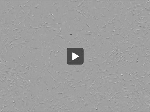 Mesenchymal Stem Cells