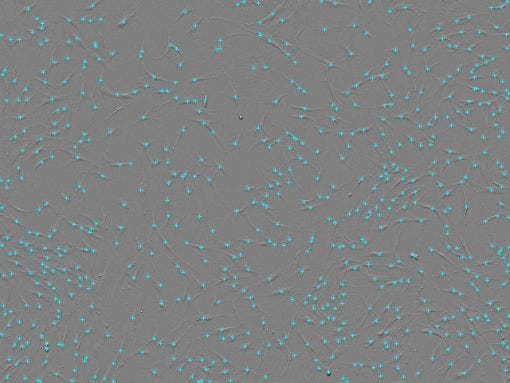 Cell count : 6.24 × 10²