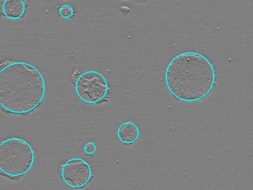 Colony count : 6.75 × 10⁰