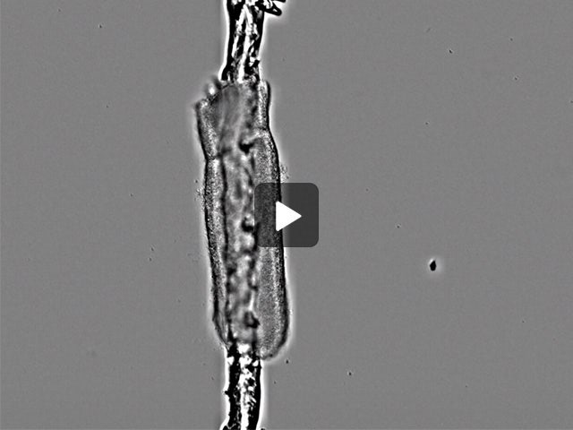 Live cell imaging recordings of E6 chick midgut explants