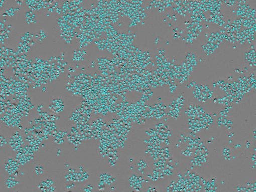 Cell count : 2.65 × 10³