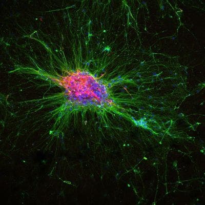 Mikroskopaufnahme eines aus iPSC entstandenen Organoids, das sich zu dopaminergen Neuronen differenzierte.