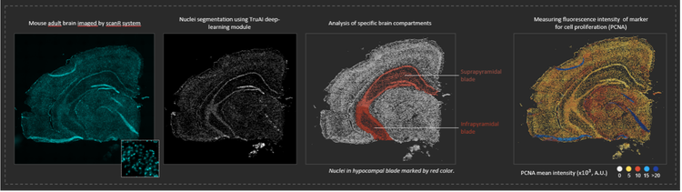 Bildanalyse einzelner Zellen im Gehirn einer erwachsenen Maus mithilfe der KI-Deep-Learning-Technologie