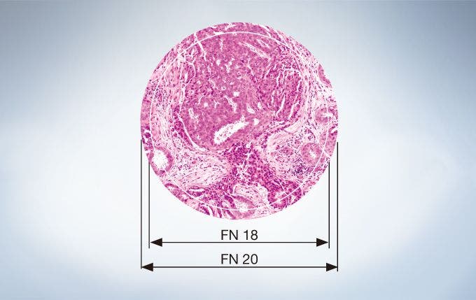 Mikroskopische Aufnahme einer Gewebeprobe, die den Unterschied zwischen FN 18 und FN 20 zeigt. FN steht für Feldnummer. Diese gibt die Blendengröße des Okulars in mm an und legt den Bildbereich der Probe fest.