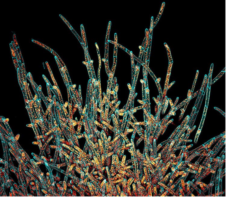 IOTY 2021 Americas Gewinnerbild mit Darstellung von Protonema-Zellen des Kleinen Blasenmützenmooses (Physcomitrium patens)