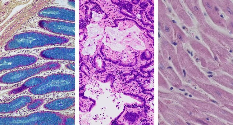 Hellfeldaufnahmen eines Dickdarms, einer HE-gefärbten Mauslunge und eines HE-gefärbten Schnitts durch ein Mausherz