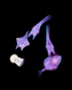 Algenpest des Dinoflagellaten Tripos hircus