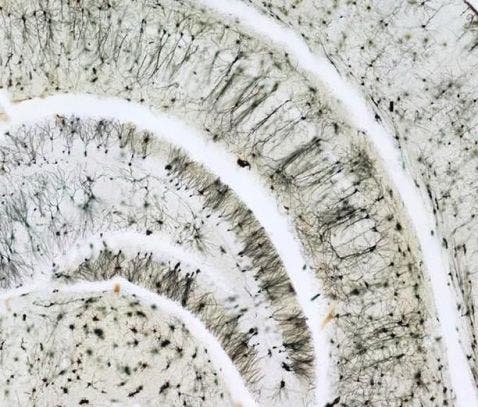 Hippocampus einer Maus