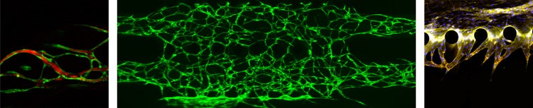 GFP- und DAPI-markierte Proben, aufgenommen mit dem IXplore Live Mikroskopsystem, mit freundlicher Genehmigung der TU Wien