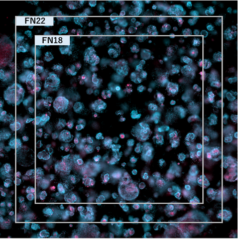 Organoids made from human iPS cells.