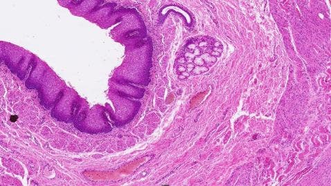 Menschliche Luftröhre