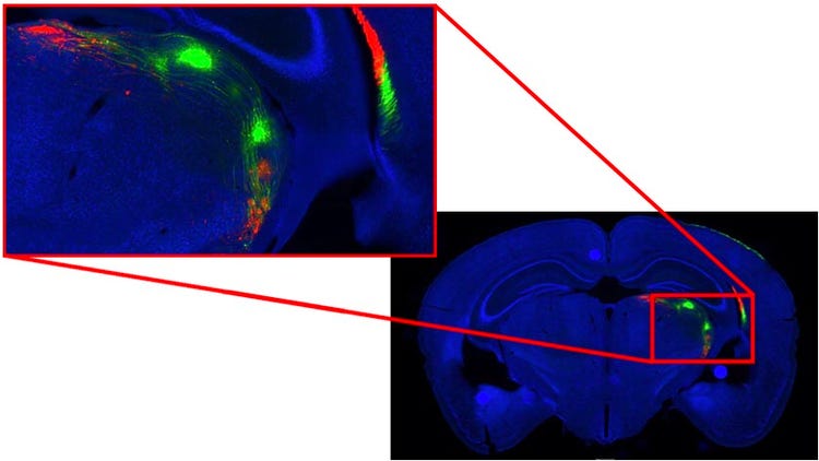 Imaging eines kompletten Objektträgers: Bild eines Mausgehirns