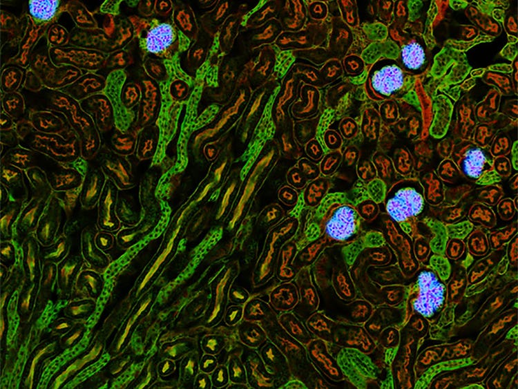 Vorhersage der Glomeruli-Positionen auf einem Maus-Nierenschnitt mit TruAI (blau).
