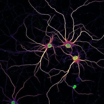 Bild von primären kortikalen Neuronen der Ratte nach 14 Tagen in vitro mit Zellkernen (grün) und sich entwickelnden Dendriten (mpl-inferno LUT) mit MAP2-Färbung, um die Umrisse der Neuronen sichtbar zu machen