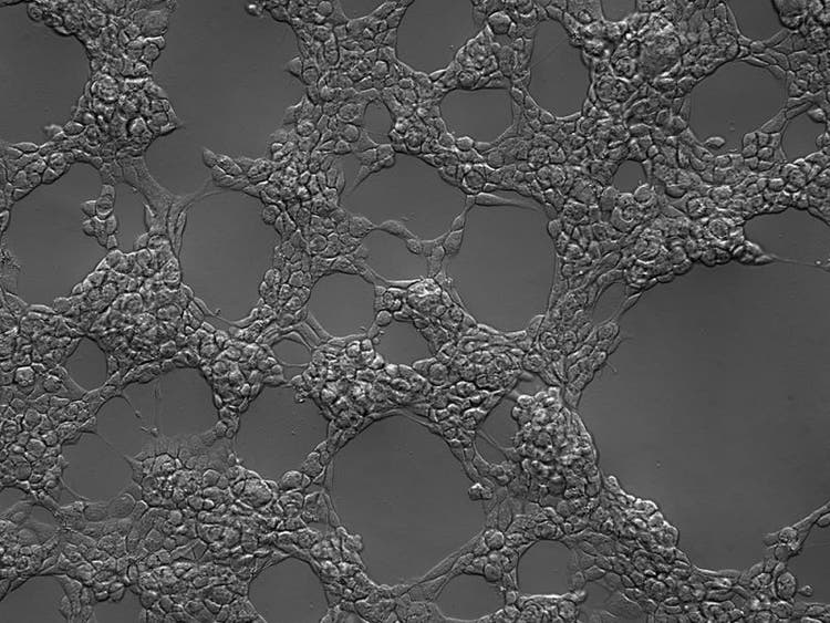 Probe mit Gradientenkontrast: HEK-293-Zellen