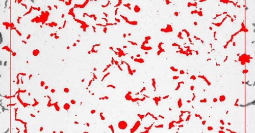 Particle Distribution (Partikelverteilung)