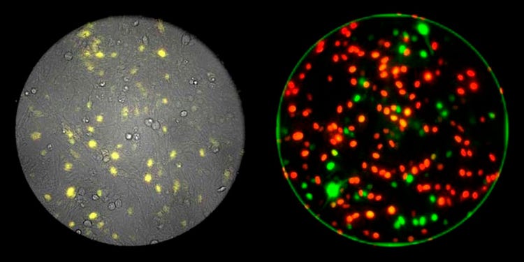 3-Kanal-Bildgebung auf Einzelzellebene mit Fluoreszenz (rechts, rot/grün), Biolumineszenz (links, gelb) und Phasenkontrast (links, Graustufen). Datenquelle: Itaru Imayoshi, Research Center for Dynamic Living Systems, Graduate School of Biostudies, Kyoto University; Akihiro Isomura, Ryoichiro Kageyama, Institute for Virus Research, Kyoto University.