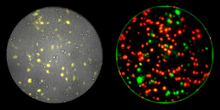 3-Kanal-Bildgebung auf Einzelzellebene mit Fluoreszenz (rechts, rot/grün), Biolumineszenz (links, gelb) und Phasenkontrast (links, Graustufen). Datenquelle: Itaru Imayoshi, Research Center for Dynamic Living Systems, Graduate School of Biostudies, Kyoto University; Akihiro Isomura, Ryoichiro Kageyama, Institute for Virus Research, Kyoto University.