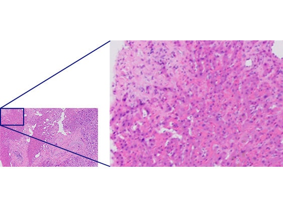 Vergleich der Auflösung