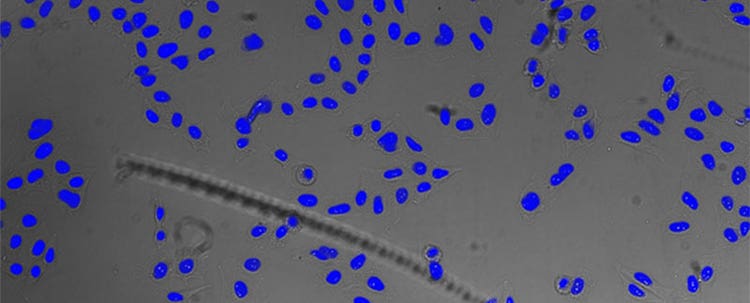 Figure 5 Nucleus detection result from transmission image by TruAI. Highly accurate detection is possible.