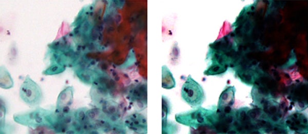 Figure 2 – An example of an image with a well-designed contrast curve (left) showing both pale bright cells and dark layered cells. The image with a poorly designed contrast curve (right) does not.