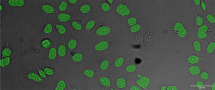 (A) GFP nuclear labels