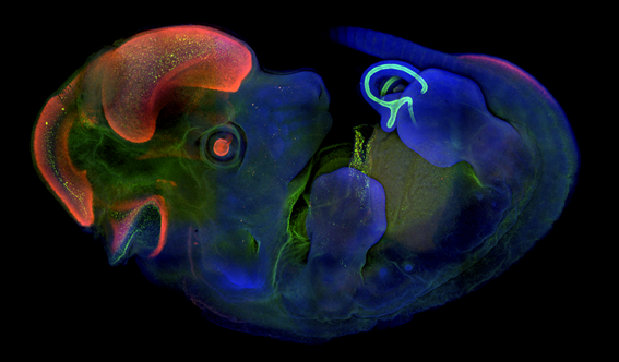 Mouse embryo. SOX1 (Cy3), CDX2 (green), DAPI (blue). Courtesy of Dr. Yingying Chen, Naihe Jing’s Lab.
