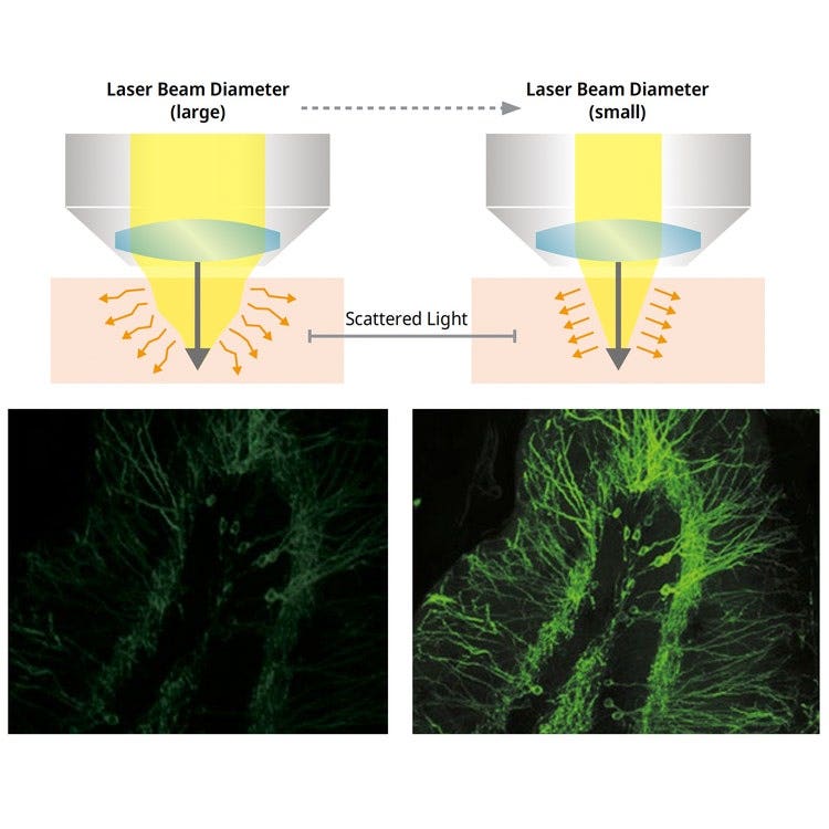 Comparison of a normal image and a Deep Focus image captured using the FLUOVIEW FV5000MPE multiphoton laser scanning microscope.