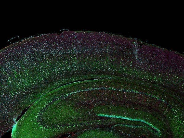 Image download failed.